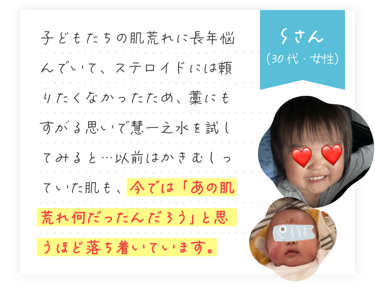 Sさん（30代・女性）